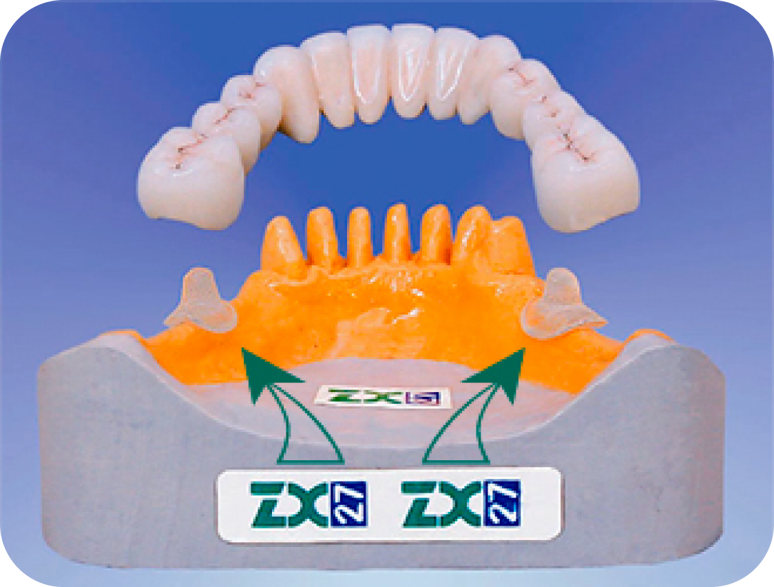 ZX27 NonSurgical Dental Implants Alternative